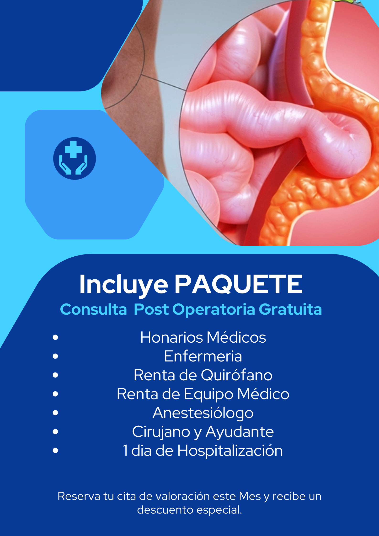 promocion diverticulitis