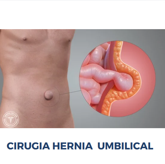 cirugia hernia umbilical